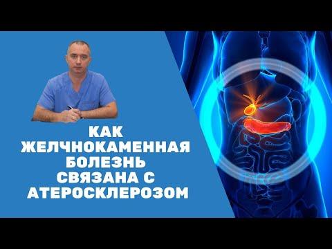 Как желчнокаменная болезнь связана с атеросклерозом