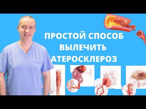 Как вылечить атеросклероз?